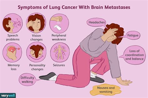The metastasis typically shares a <strong>cancer</strong> cell type with the original site of the <strong>cancer</strong>. . Stage 4 lung cancer spread to brain and bones life expectancy